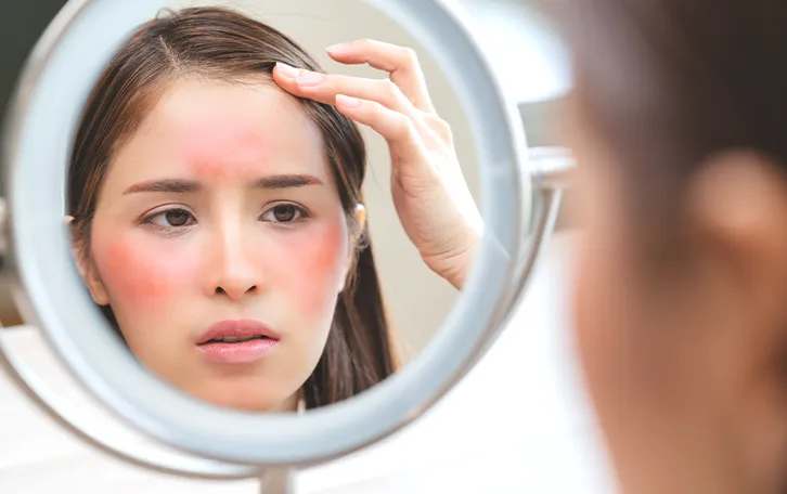 Behandlung von Sonnenbrand Sonnenallergie Juckreiz Eine weibliche Person betrachtet Ihr gerötetes Gesicht in einem runden Spiegel.