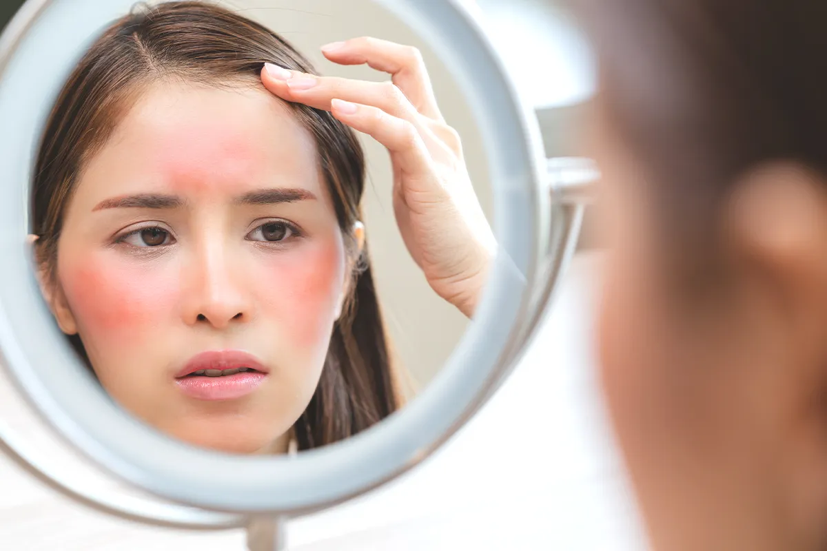 Häufigsten Ursachen fĂ¼r Hautrötungen Eine weibliche Person stĂ¼tzt den Kopf auf einen Arm und sieht gestresst aus